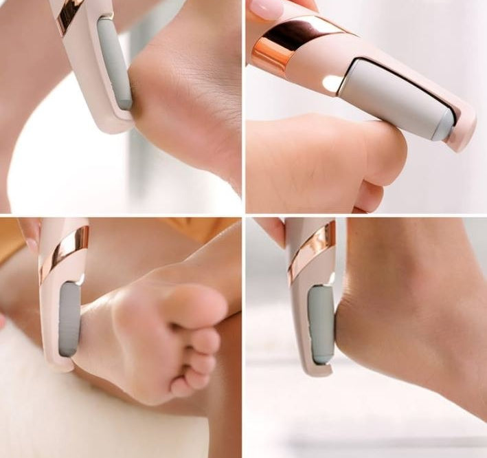 Electric Foot Filter- Soft & Smooth Feet at Home